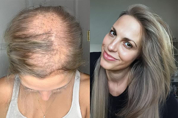 the great effectiveness of HaloGrow